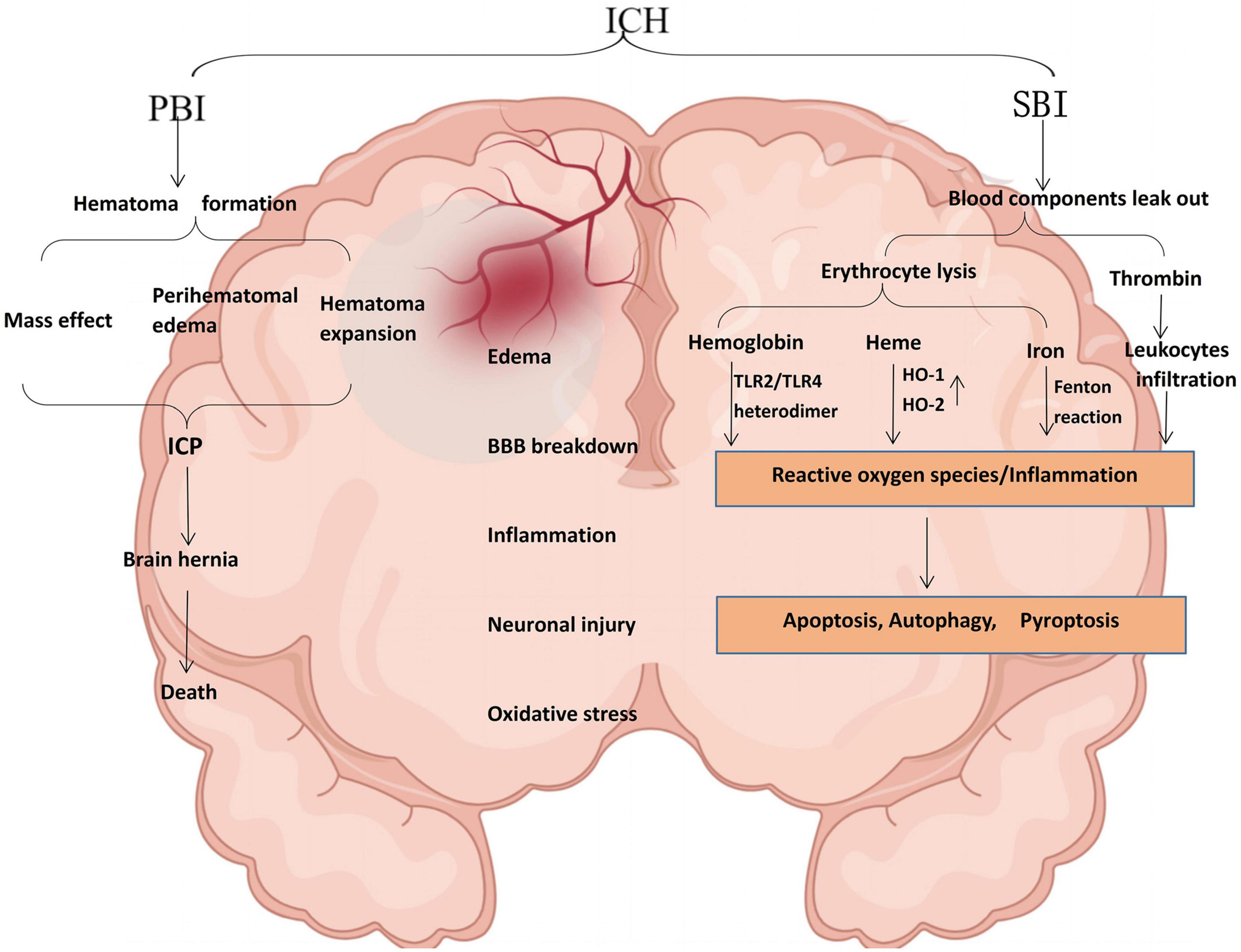 Frontiers | Autophagy regulates inflammation in intracerebral 